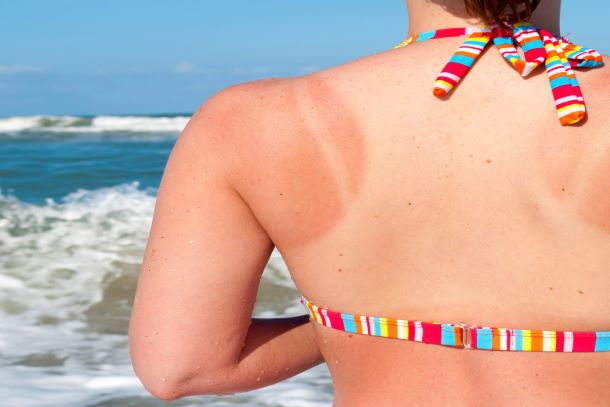 lady with her back shown in a swimsuit